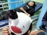 Asep NS : Saya Harap Polisi Serius Tangani LP Penganiayaan/Pembacokan Terhadap Anak Saya